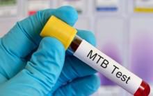 A step closer in developing a test for Tuberculosis: AHRI postdoctoral scientist is co-developer of a novel diagnostic assay ready for field evaluation